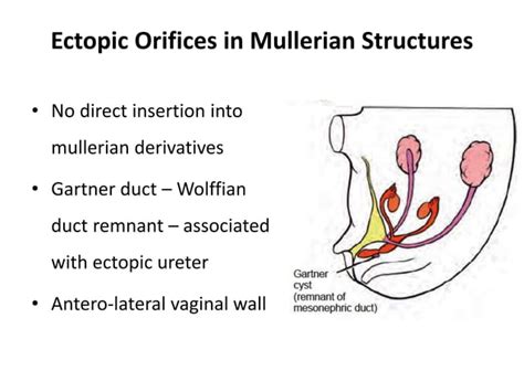 Ectopic ureter and ureterocele - Embryology and Presentation | PPT