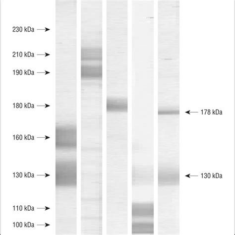 Immunoblotting using normal human epidermal extracts as the source of ...