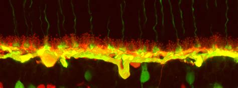 Horizontal cells – Retinal Microscopy