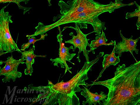 Epi-Fluorescence – Martin Microscope