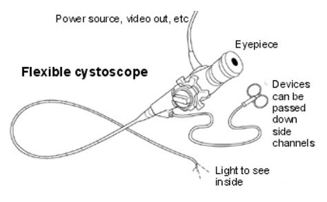 Flexible cystoscopy - Urology Waikato