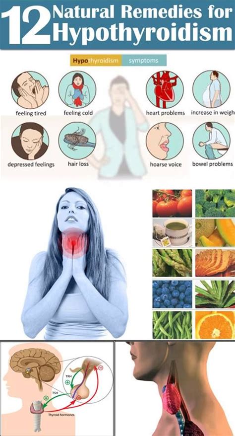 12 Simple Remedies for Hypothyroidism | Hypothyroidism, Health