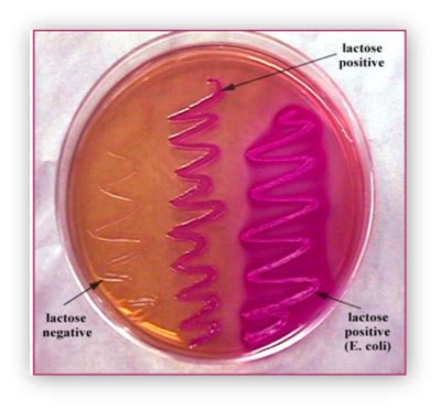 MacConkey Agar Plates- Know Your Media - Advancells Group