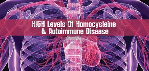 High Levels Of Homocysteine Linked To Autoimmune - Hashimoto's, Need to ...