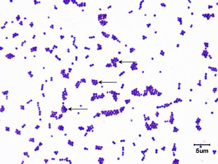 Staphylococcus Epidermidis Gram Stain