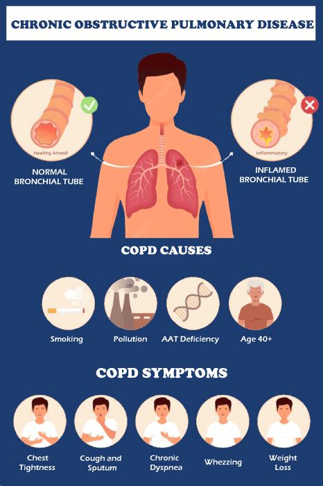 COPD Full Form in Medical: Chronic Obstructive Pulmonary Disease ...