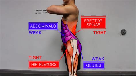 Fix Anterior Pelvic Tilt in 10 Minutes Per Day with This Corrective Routine