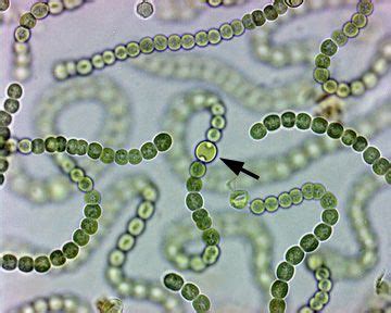 Nostoc-Cyanobacteria | Small. | Pinterest