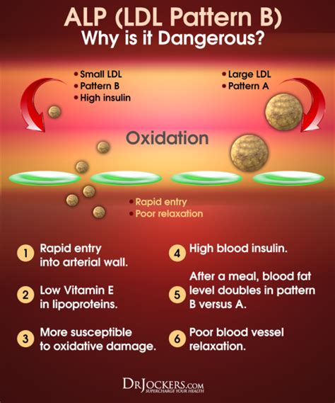 High Cholesterol on a Ketogenic Diet - DrJockers.com