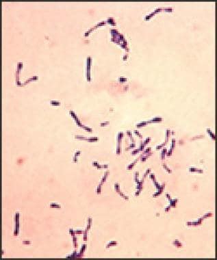 Corynebacterium Diphtheriae Simple Stain