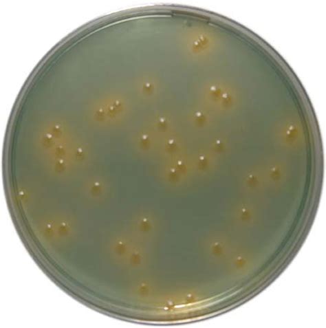 PP0080 - CLED Agar - E & O Laboratories Ltd