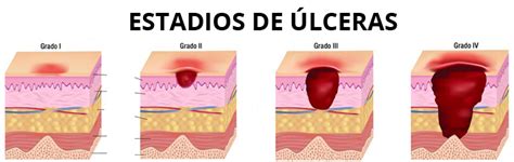 ZHa30 nov-dic 2020 Aragón archivos - Zona Hospitalaria