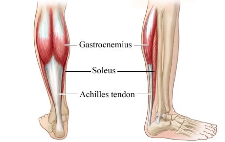 Achilles Tendinosis - Causes and Treatment | Bone and Spine