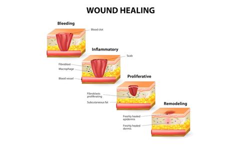 TIME Wound Assessment Archives - Sergio Mazzei