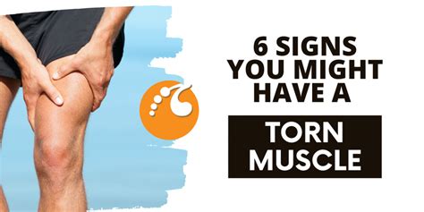 6 Signs That You Might Have a Torn Muscle – Dayton Orthopaedic Surgery