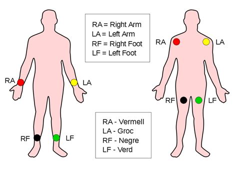 ekg lead placement - - Image Search Results | Enfermeria, Consejos ...