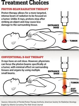 Proton Beam Therapy Prostate Cancer | COMPLICATIONS OF PROSTATE CANCERS ...