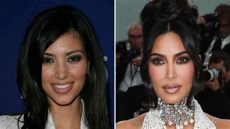 Kim Kardashian Before And After: Plastic Surgery Timeline | Life & Style