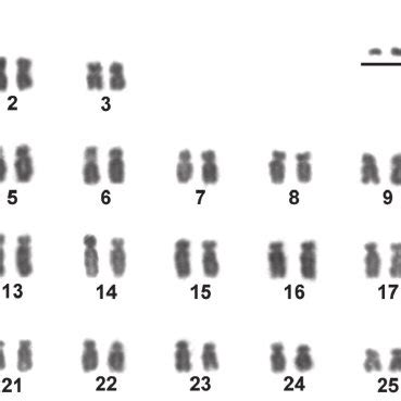 Giemsa-stained karyotype showing 2n = 50 chromosomes of one individual ...