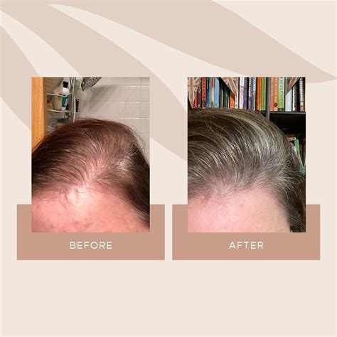 Hair Growth Journey | Vegan hair, Hair serum, Hair growth serum