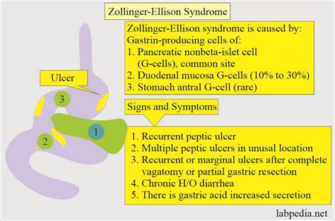 Gastrin Level, and Zollinger-Ellison Syndrome - Labpedia.net