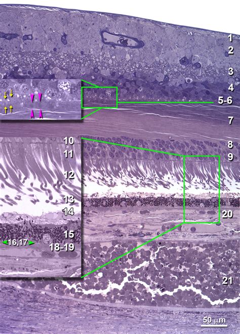 Macula and Chorioretinal Layers – Project MACULA