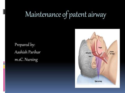 management of airway