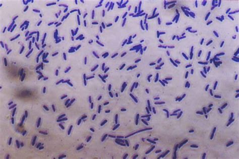 File:Bacteria photomicrograph.jpg - Wikimedia Commons