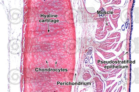 Tracheal Cartilage Histology