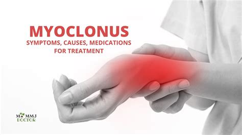 Myoclonus: Diagnosis and Treatment