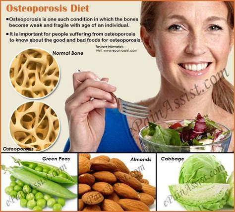 Osteoporosis Diet: Good and Bad Foods for Osteoporosis | Osteoporosis diet, Osteoporosis, Diet