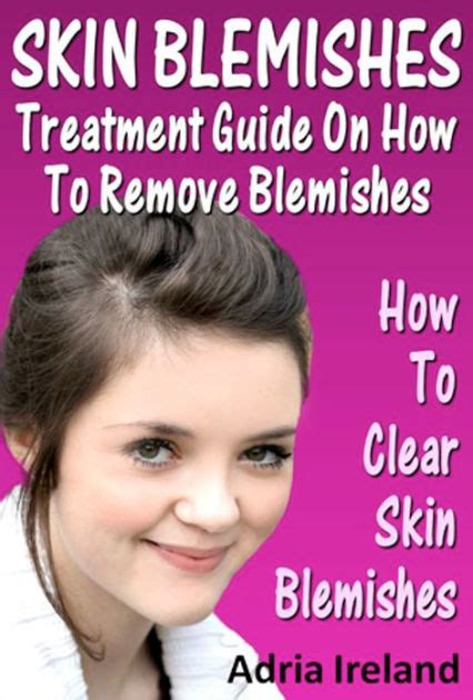 Skin Blemishes : Treatment Guide On How To Remove Blemishes And Clear ...