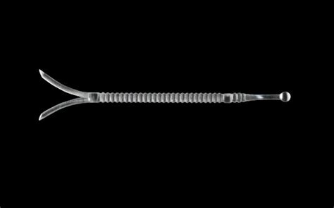 Spirox Announces Positive Clinical Study Results for LATERA Implant in Patients with Nasal Valve ...