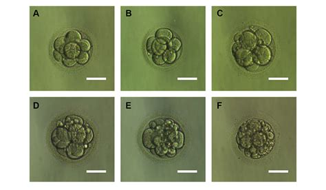 Embryo Grading - Quality Chart and IVF Success Rates