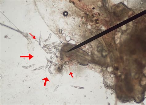 25 New Demodex Mites Under Microscope - Demodectic Mange