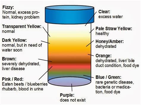 Urine Color Can Determine A Person's Health Status