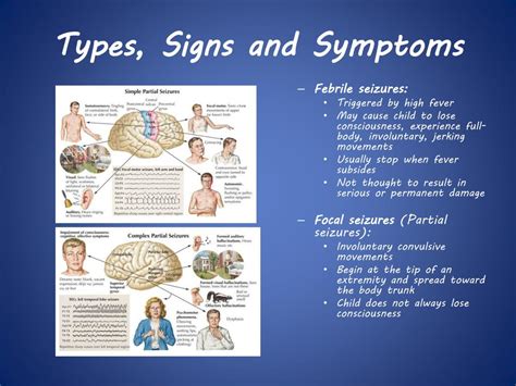 Seizures System Disorder Template