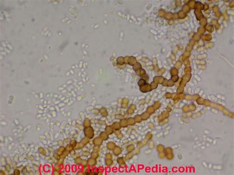 Green White or Black Mold under the Microscope