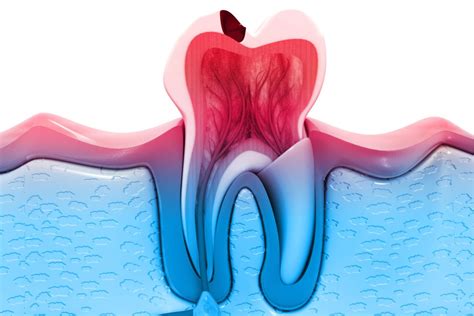 Endodontics - Bethesda Family Dentistry