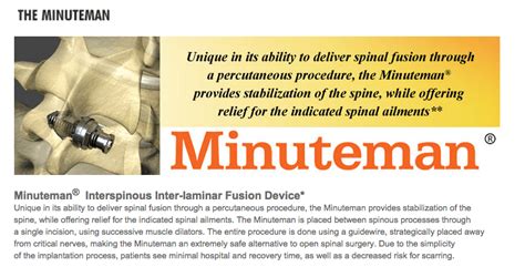 Spinal Simplicity Announces FDA 510(k) Clearance of the Minuteman Lateral Percutaneous ...