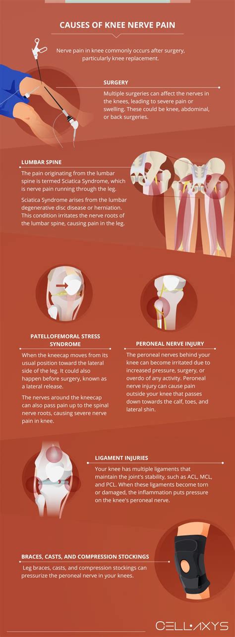 Nerve Pain In Knee: Causes, Symptoms, And Treatment - Cellaxys