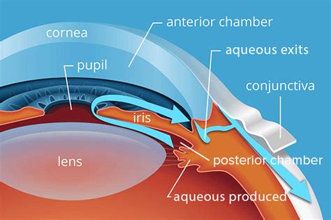 Intraocular Pressure - All About Vision