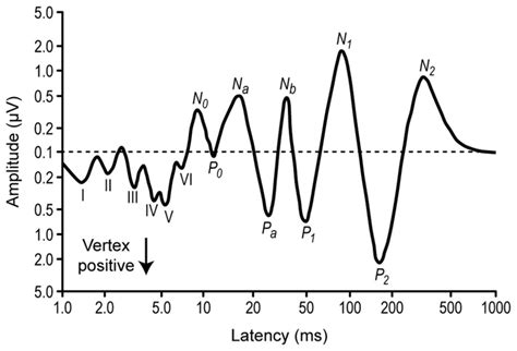 Evoked potentials, auditory; Auditory Evoked Potentials; Auditory Evoked Response