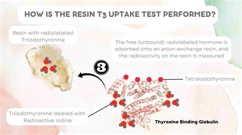 T3 Resin Uptake (T3RU) : A Detailed Guide - My Endo Consult