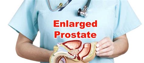 HealthcareTurkey - Prostate Enlargement treatment- Is it useful?