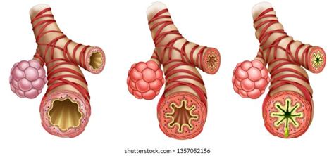 Illustration Showing Three Portions Bronchi Arveoli Stock Illustration ...