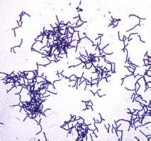 Actinomyces israelii NEUF2011 - microbewiki