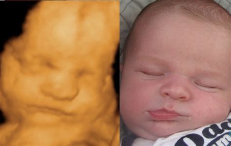 Before & After Photo Gallery – 3D and 4D Ultrasound Virginia | Baby ultrasound pictures, Baby ...