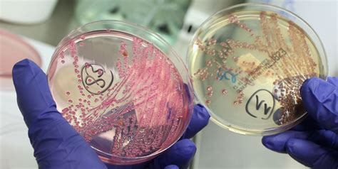 E. Coli Outbreak Affects Seven U.S. States, CDC Investigating