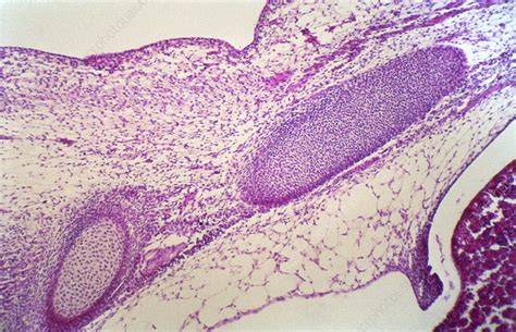 Mesenchymal Connective Tissue (LM) - Stock Image - C022/2216 - Science ...